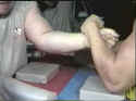 Broken Arm-012.JPG (32553 bytes)